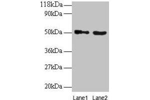 Western blot All lanes: VOPP1 antibody at 2 μg/mL Lane 1: EC109 whole cell lysate Lane 2: 293T whole cell lysate Secondary Goat polyclonal to rabbit IgG at 1/15000 dilution Predicted band size: 20, 19, 18 kDa Observed band size: 50 kDa (VOPP1 anticorps  (AA 23-172))