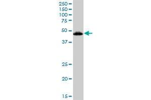VDR MaxPab polyclonal antibody.