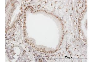 Immunoperoxidase of monoclonal antibody to IFI16 on formalin-fixed paraffin-embedded human prostate. (IFI16 anticorps  (AA 630-729))