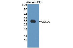 Western blot analysis of the recombinant protein. (VEGFB anticorps  (AA 21-207))