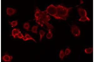 ABIN6274805 staining Hela by IF/ICC. (ACOT2 anticorps  (Internal Region))