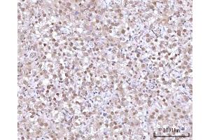 IHC analysis of RNGTT using anti-RNGTT antibody (ABIN7599723).