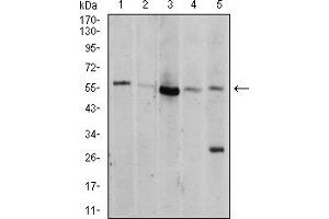 Western Blotting (WB) image for anti-V-Akt Murine Thymoma Viral Oncogene Homolog 1 (AKT1) (AA 1-150) antibody (ABIN5856183)