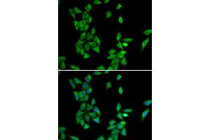 Immunofluorescence analysis of HeLa cells using ANXA4 antibody (ABIN6290015). (Annexin IV anticorps)