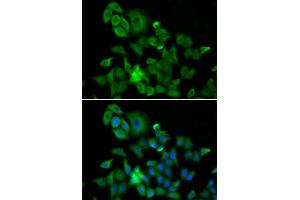 Immunofluorescence analysis of A549 cell using HMMR antibody. (HMMR anticorps  (AA 341-440))