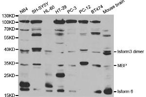 Western blot analysis of extracts of various cell lines, using MBP antibody. (MBP anticorps)