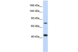 WB Suggested Anti-LRP8 Antibody Titration:  0. (LRP8 anticorps  (Middle Region))