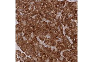 Immunohistochemical staining of human pancreas with ARHGEF10L polyclonal antibody  shows strong cytoplasmic positivity in exocrine cells at 1:10-1:20 dilution. (ARHGEF10L anticorps)