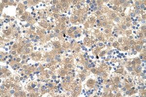 Image no. 1 for anti-Cyclophilin B (PPIB) (C-Term) antibody (ABIN205044)