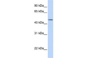 WB Suggested Anti-TBL2 Antibody Titration: 0. (TBL2 anticorps  (N-Term))