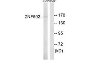 Western blot analysis of extracts from K562 cells, using ZNF592 Antibody. (ZNF592 anticorps  (AA 961-1010))