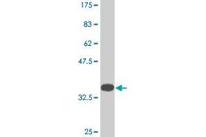 Western Blot detection against Immunogen (35. (KDM5B anticorps  (AA 231-319))