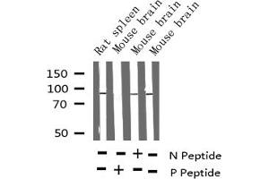 Western blot analysis of Phospho-PKC-pan (Thr497) expression in various lysates