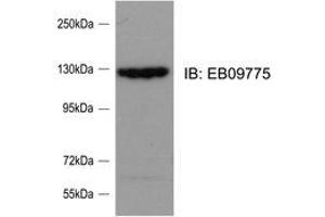 Western Blotting (WB) image for anti-SLIT-ROBO rho GTPase Activating Protein 2 (SRGAP2) (Internal Region) antibody (ABIN2464859)