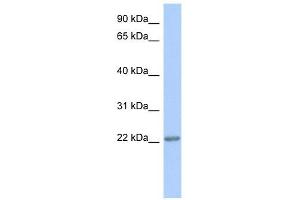 TRAPPC5 antibody used at 1 ug/ml to detect target protein. (TRAPPC5 anticorps  (Middle Region))
