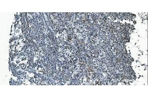 IHC analysis of MCU using anti-MCU antibody (ABIN7601931). (MCU anticorps  (AA 51-351))