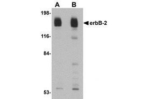 Western blot analysis of erbB-2 in rat liver tissue lysate with AP30319PU-N erbB-2 antibody at (A) 1 and (B) 2 μg/ml. (ErbB2/Her2 anticorps  (C-Term))