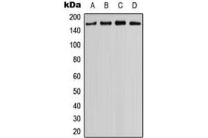 Western blot analysis of MYO3B expression in NCIH460 (A), HEK293T (B), mouse eye (C), rat kidney (D) whole cell lysates. (MYO3B anticorps  (C-Term))