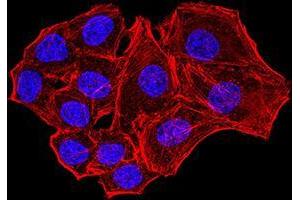 Immunofluorescence analysis of Hela cells using NS1 mouse mAb. (Parvovirus B19 NS1 (AA 1-216) anticorps)