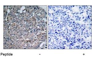 Image no. 1 for anti-PTK2 Protein tyrosine Kinase 2 (PTK2) (Tyr925) antibody (ABIN197348)