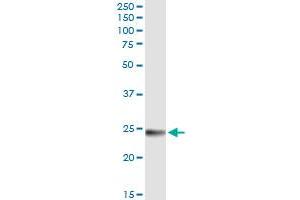 Immunoprecipitation of WISP2 transfected lysate using anti-WISP2 MaxPab rabbit polyclonal antibody and Protein A Magnetic Bead , and immunoblotted with WISP2 MaxPab mouse polyclonal antibody (B01) .