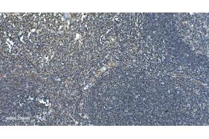 IHC analysis of LSM7 using anti-LSM7 antibody (ABIN7598937). (LSM7 anticorps  (AA 1-103))