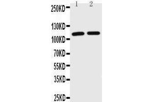 Anti-TRIF antibody, Western blotting Lane 1: JURKAT Cell Lysate Lane 2: HL-60 Cell Lysate