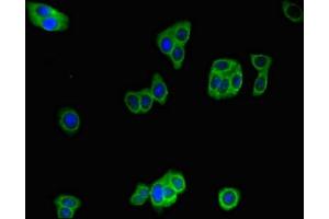Immunofluorescent analysis of HepG2 cells using ABIN7156344 at dilution of 1:100 and Alexa Fluor 488-congugated AffiniPure Goat Anti-Rabbit IgG(H+L)