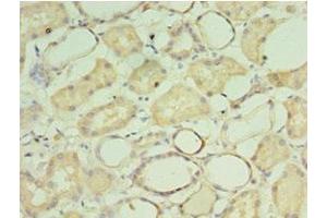 Immunohistochemistry of paraffin-embedded human kidney tissue using ABIN7149543 at dilution of 1:100 (CRADD anticorps  (AA 1-199))