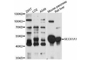 Western blot analysis of extracts of various cell lines, using SEC61A1 antibody (ABIN5998770) at 1:3000 dilution. (SEC61A1 anticorps)
