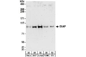 Western Blotting (WB) image for anti-Ubiquitin Protein Ligase E3A (ube3a) (AA 75-125) antibody (ABIN7449574)