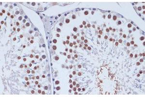 Immunohistochemistry of paraffin-embedded Rat testis using DNMT3L Polyclonal Antibody at dilution of 1:100 (40x lens).