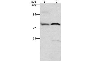 Western Blot analysis of 293T cell and Human fetal brain tissue using ATXN1 Polyclonal Antibody at dilution of 1:800 (Ataxin 1 anticorps)