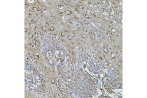 Immunohistochemistry of paraffin-embedded human esophagus using FLNB antibody.