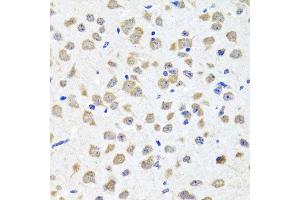 Immunohistochemistry of paraffin-embedded mouse brain using PIP4K2B antibody at dilution of 1:100 (x40 lens). (PIP4K2B anticorps)