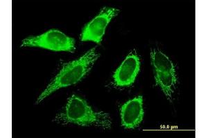 Immunofluorescence of purified MaxPab antibody to SLC25A3 on HeLa cell.