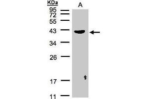 WB Image Sample(30 μg of whole cell lysate) A:Raji, 12% SDS PAGE antibody diluted at 1:500 (Pleckstrin anticorps  (C-Term))