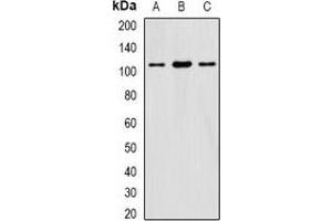 Western blot analysis of eIF3C expression in HepG2 (A), SW620 (B), mouse testis (C) whole cell lysates. (EIF3C anticorps)