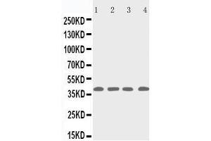 Anti-p53R2 antibody, Western blotting Lane 1: Rat Thymus Tissue Lysate Lane 2: MCF-7 Cell Lysate Lane 3: A431 Cell Lysate Lane 4: HELA Cell Lysate (RRM2B anticorps  (C-Term))