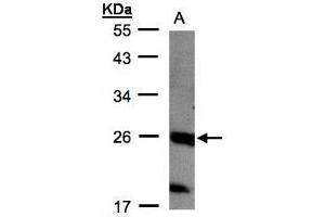 WB Image Sample(30 μg of whole cell lysate) A:MOLT4, 12% SDS PAGE antibody diluted at 1:1000 (C1orf57 anticorps  (C-Term))