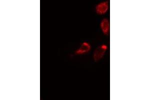 ABIN6275307 staining 293 cells by IF/ICC. (Septin 3 anticorps  (Internal Region))