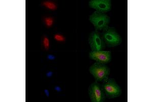 ABIN6256860 and ABIN6274329 staining  cells by IF/ICC. (FOXC1 anticorps  (Internal Region))