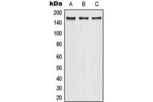 Western blot analysis of CD206 expression in HepG2 (A), Caco2 (B), NIH3T3 (C) whole cell lysates. (Macrophage Mannose Receptor 1 anticorps  (Center))
