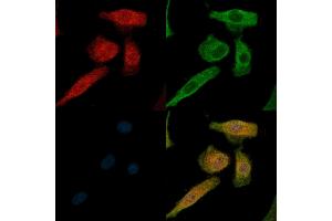 Phospho-IL4R/CD124 (Tyr497) Antibody staining A549 cells(H2O2 treatment) by IF/ICC. (IL4 Receptor anticorps  (pTyr497))