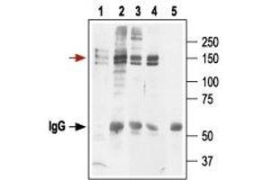 Immunoprecipitation of KV11.