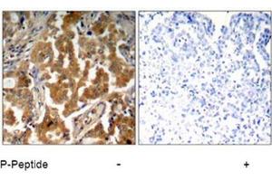 Image no. 1 for anti-Adducin 1 (Alpha) (ADD1) (pSer726) antibody (ABIN196918) (alpha Adducin anticorps  (pSer726))