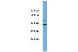 WB Suggested Anti-C21orf58 Antibody Titration: 0. (C21orf58 anticorps  (N-Term))