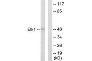 Western blot analysis of extracts from HeLa cells, using Elk1 Antibody. (ELK1 anticorps  (AA 1-50))