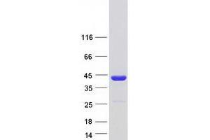 Validation with Western Blot