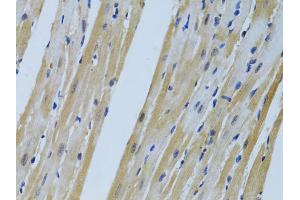 Immunohistochemistry of paraffin-embedded mouse heart using FHL2 antibody (ABIN1872694) at dilution of 1:100 (40x lens). (FHL2 anticorps)